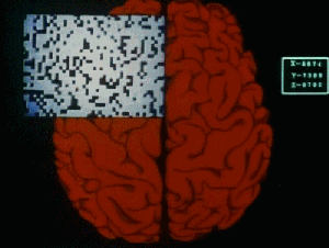 Brain-Activity-of-Pot-Smokers-Score-Addicaid